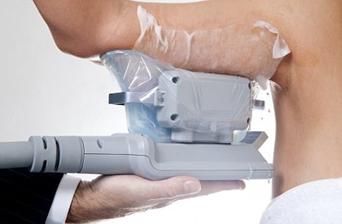 fat freezing arms Winchmore Hill