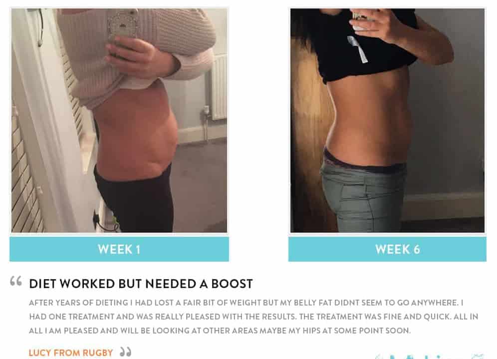 Before and After Dieting Winchmore Hill