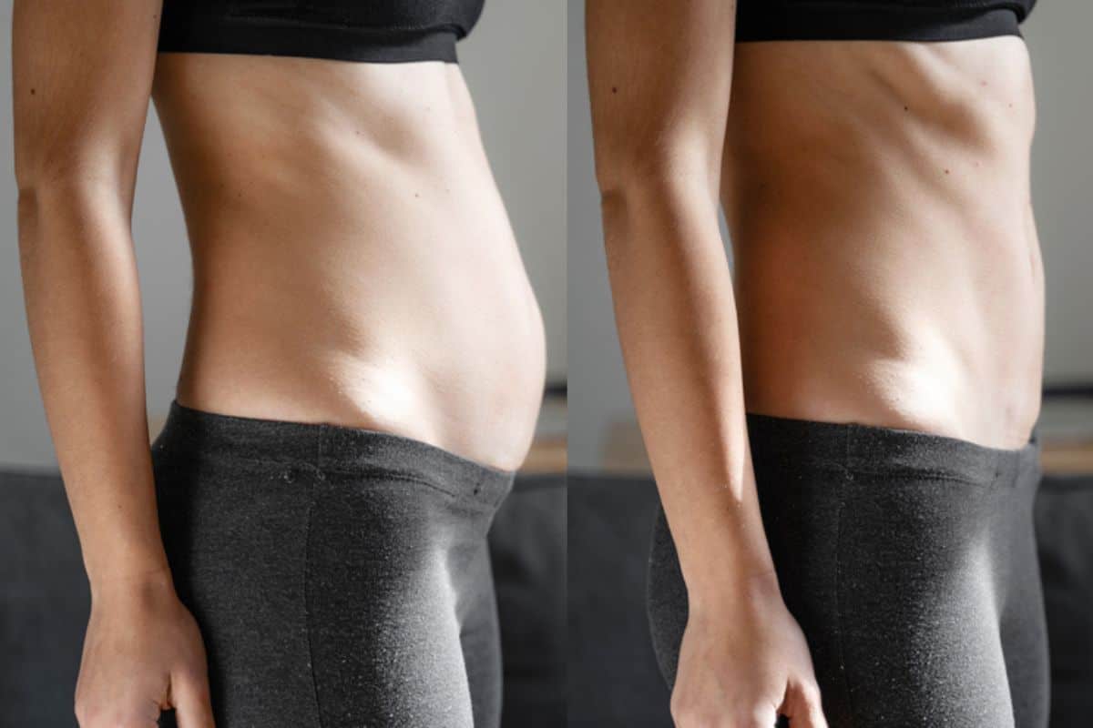 Post-Pregnancy: What Happens to Your Abdominal Muscles After Birth Winchmore Hill