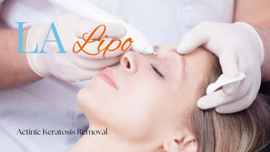 actinic keratosis removal Winchmore Hill