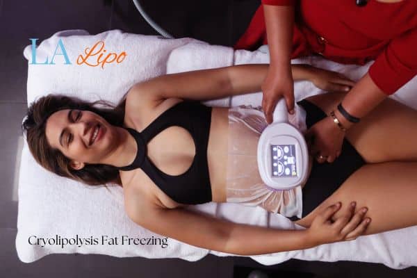 woman getting cryolipolysis Winchmore Hill