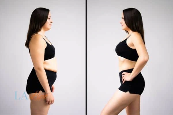 LA-EMS Body Sculpting Winchmore Hill results before and after of womans results on body toning.