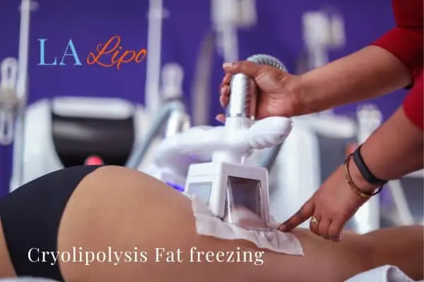 women getting fat freezing Winchmore Hill