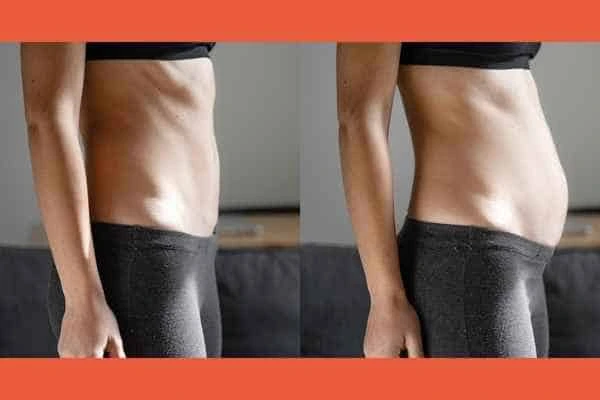 LA-EMS Body Sculpting results Winchmore Hill