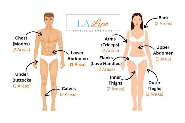 LA LIPO Cryolipolysis Areas Winchmore Hill