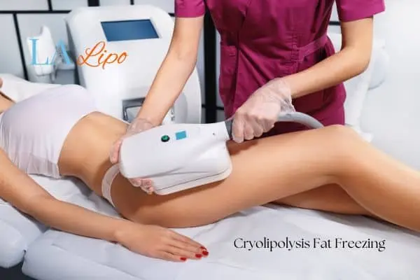 Woman receiving coolsculpting Winchmore Hill treatment on her thighs