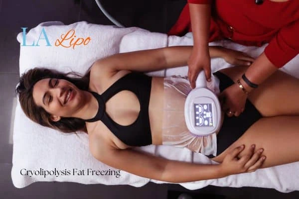 woman getting cryolipolysis Winchmore Hill