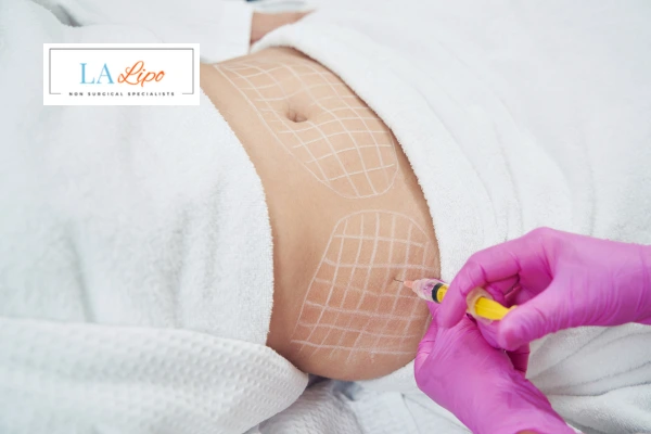 aqualyx fat dissolving injections Winchmore Hill