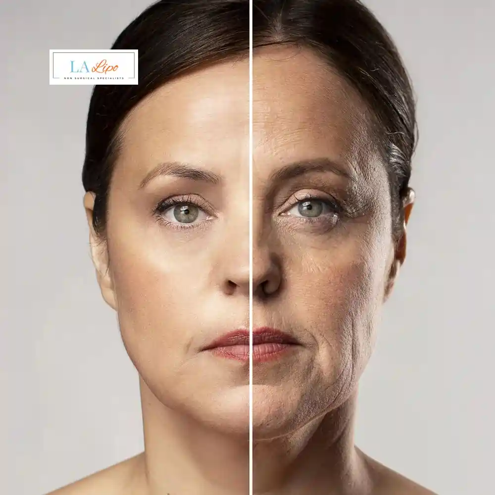 How Can You Tell If Non-Surgical Skin Tightening Is Right for You Winchmore Hill?