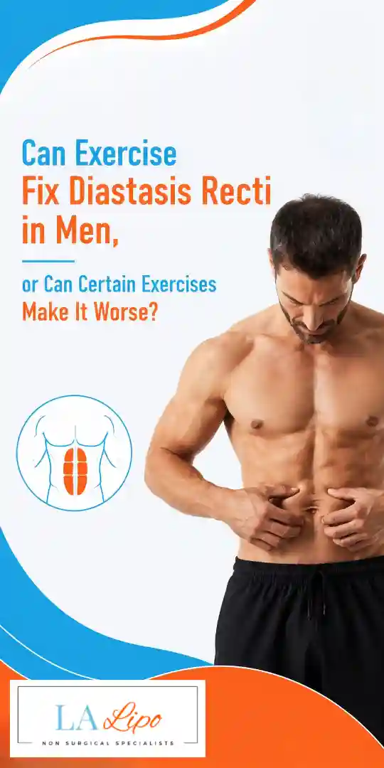 Can Exercise Fix Diastasis Recti in Men, or Can Certain Exercises Make It Worse Winchmore Hill?