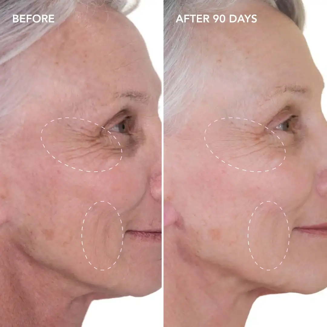 When will you see results Winchmore Hill
